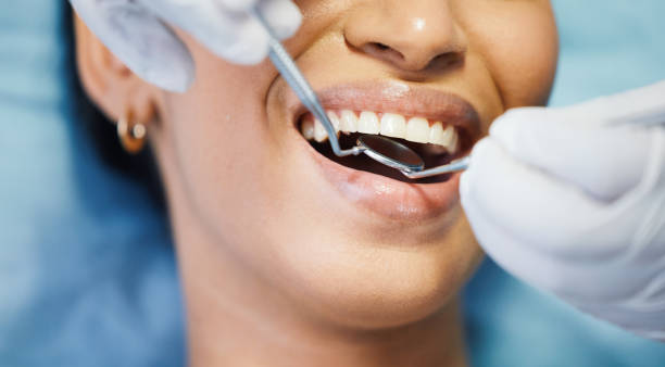 Best Urgent Care for Lost Fillings or Crowns in Winsted, MN